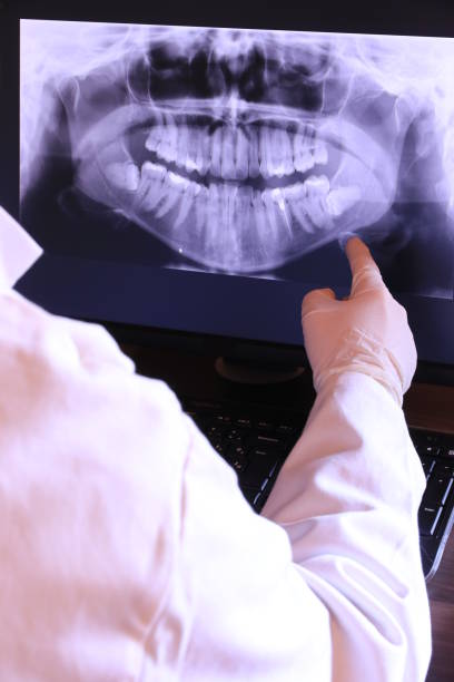 Best Emergency Tooth Extraction in Somerset, MD